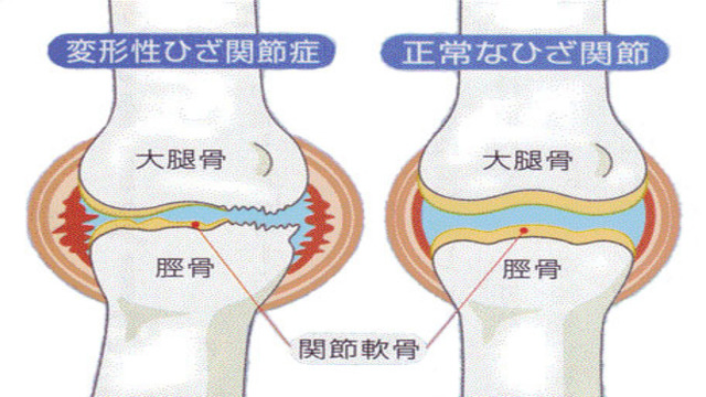 膝関節解剖図